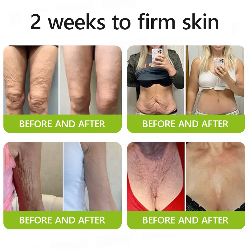 [🔥Τελευταία μέρα με έκπτωση 70%] Ένεση Botox και ρετινόλης ODALIT™ - μειώνει τις βαθιές ρυτίδες, τα χαλαρά μάγουλα και τα πρησμένα μάτια