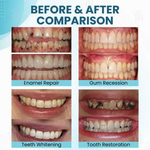 AEXZR® Makesmile Σκόνη για Στοματική Θεραπεία με Δηλητήριο Μέλισσας